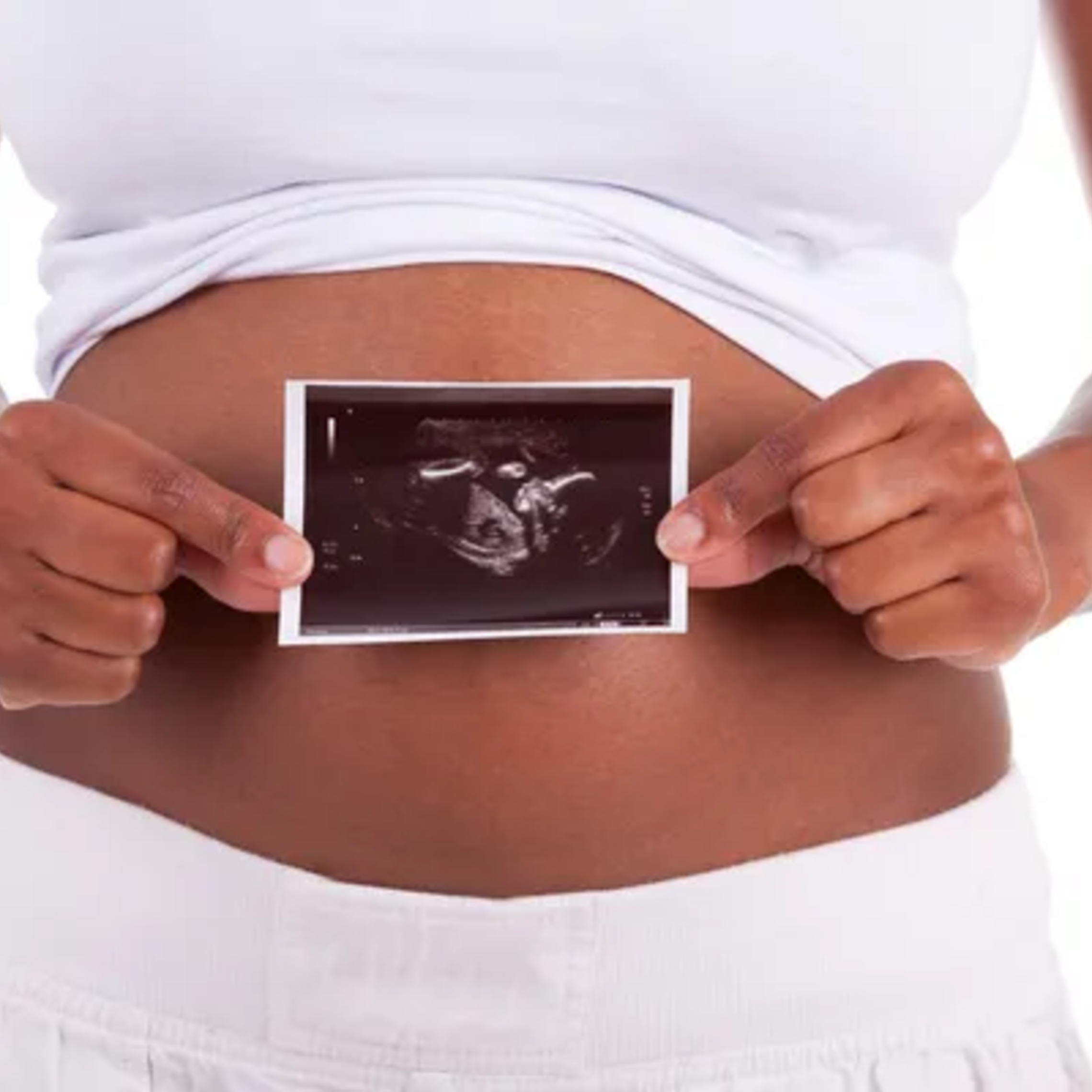 Woman Showing Sonogram